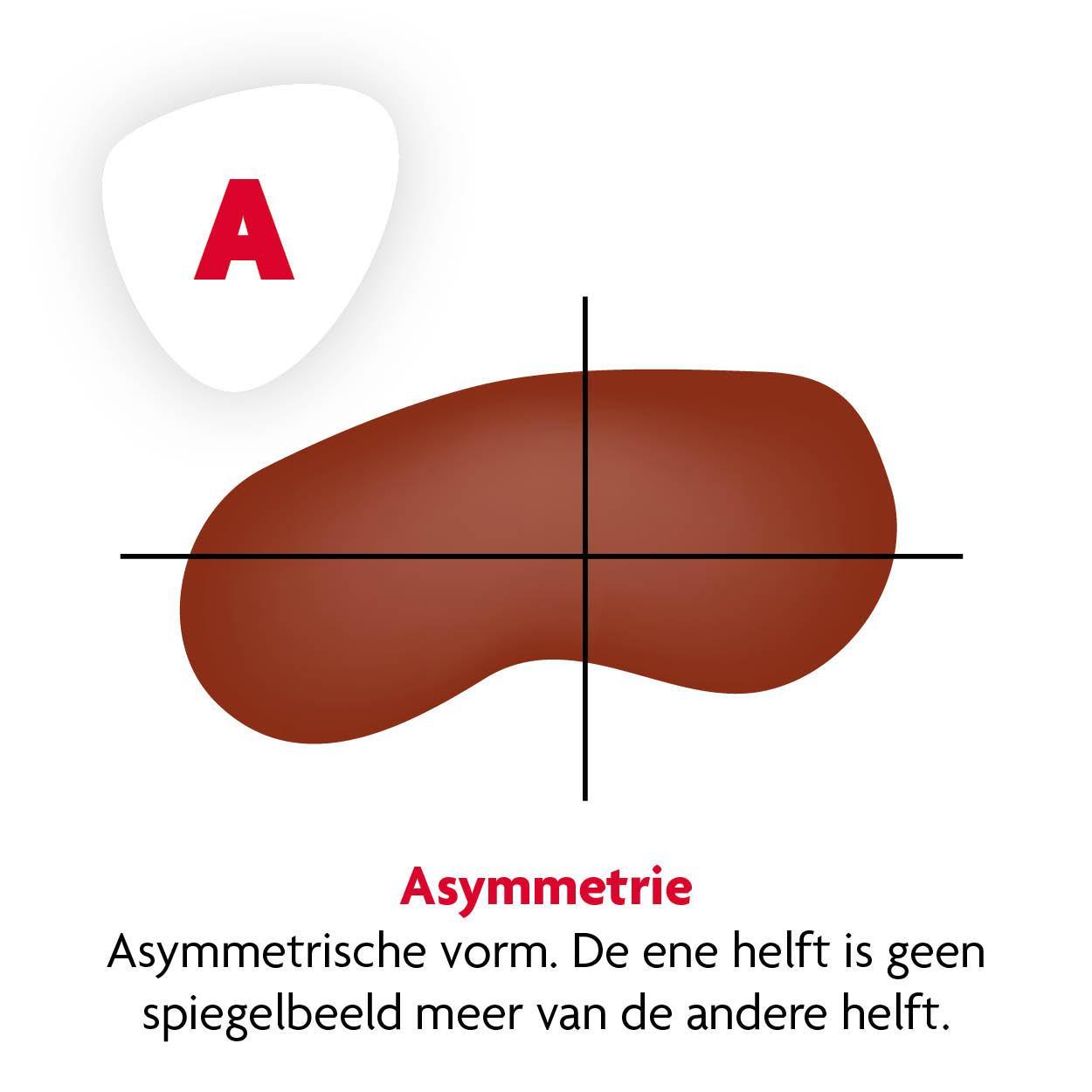 Vlekje A Vlekje A