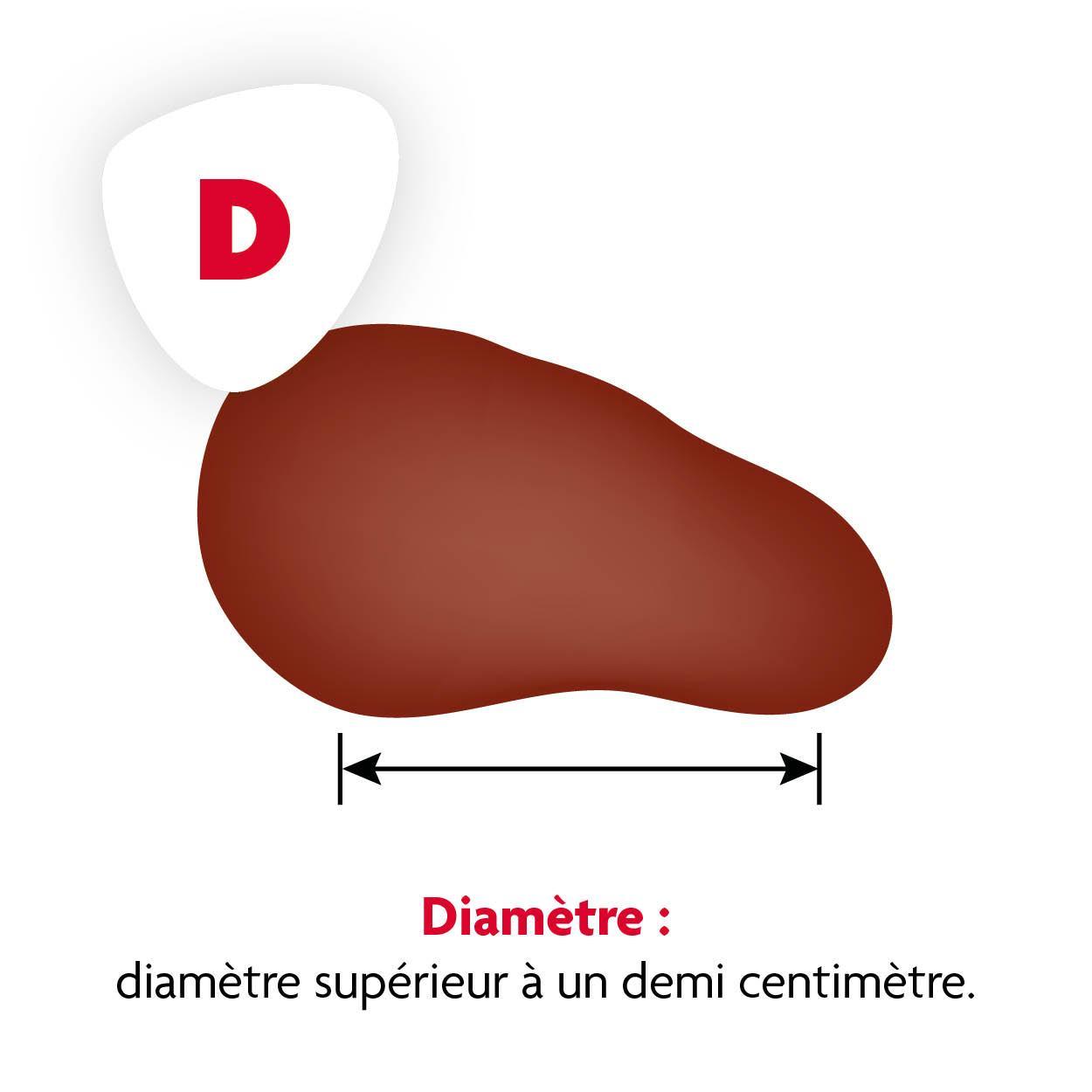 Vlekje D Vlekje D