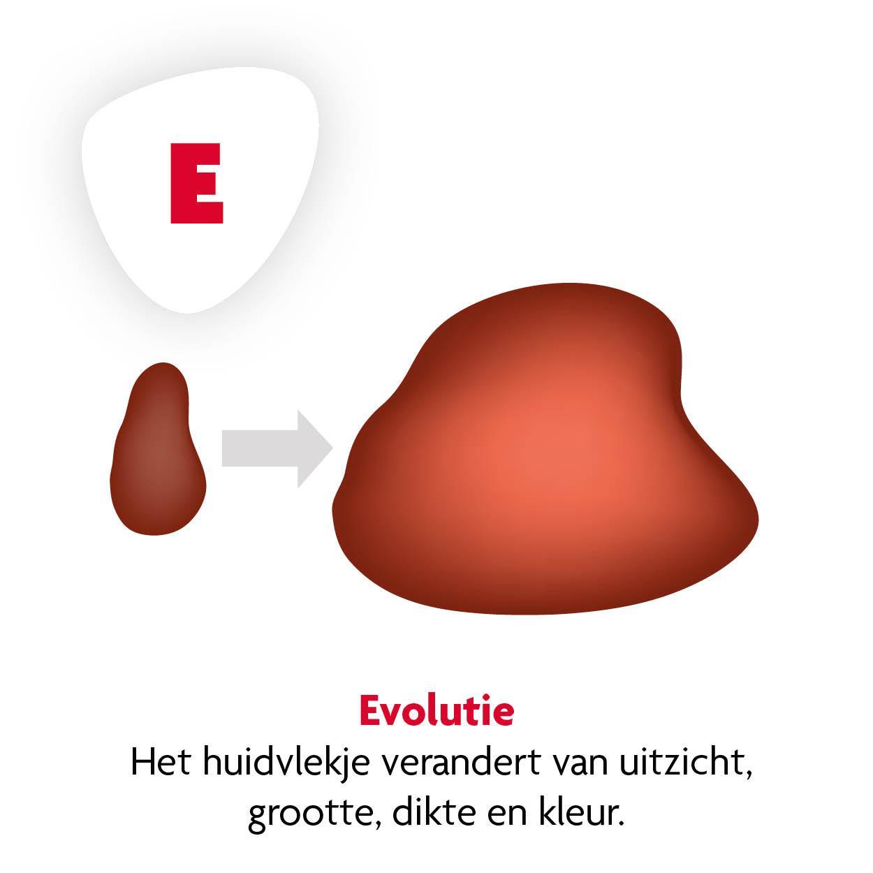 Vlekje E Vlekje E