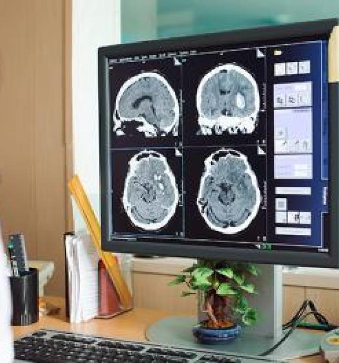 Analyse mri