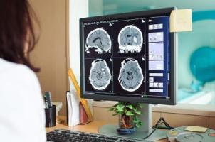 Analyse mri