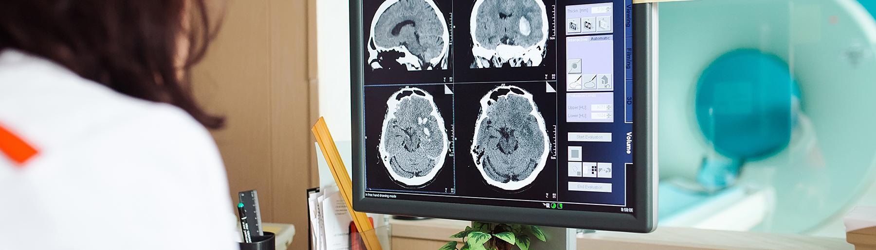 MRI op scherm