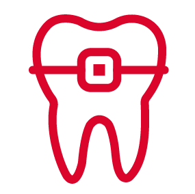 braces